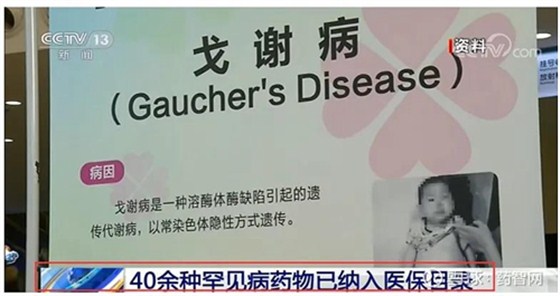 罕见病